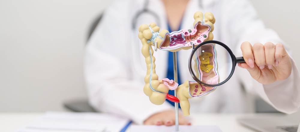 EC + FOLFIRI improves response rates in BRAF V600E-mutant mCRC